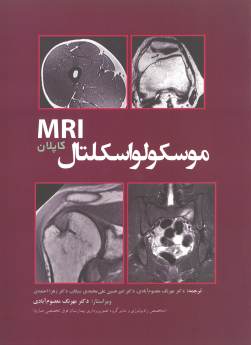 موسکولواسکلتال MRI کاپلان